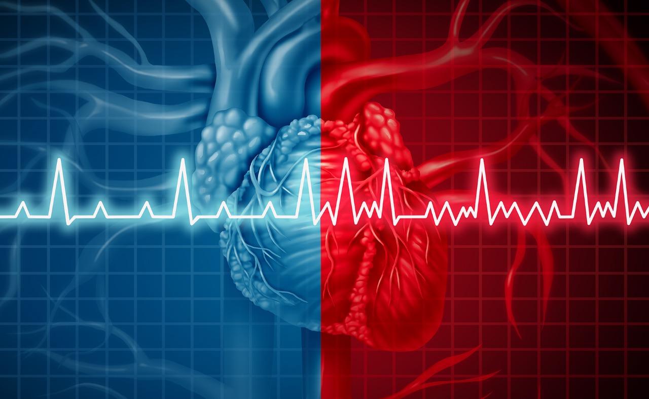 ماذا تعرف عن اضطراب نظم القلب ؟